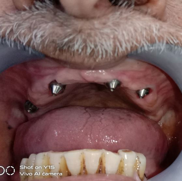 Slider image (4) THE DENTAL PORT